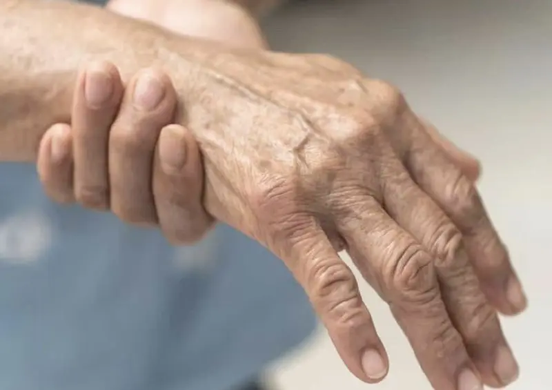 Maharashtra Sees Surge in Guillain-Barré Syndrome Cases as Solapur Reports Nine New Patients.