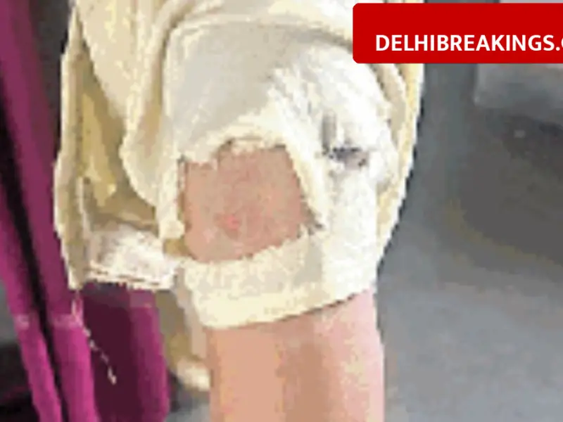 delhibreakings stray dog attack vasant kunj delhi news Stray Dog Menace in Vasant Kunj: Domestic Help Attacked, 15 People Bitten in January